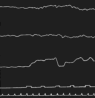 Fig. 10.