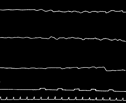 Fig. 11.