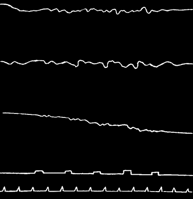 Fig. 12.